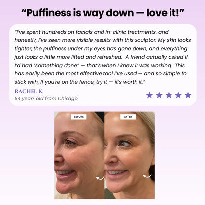 Lunara™ The Sculptor - Facial Massage Beauty Roller